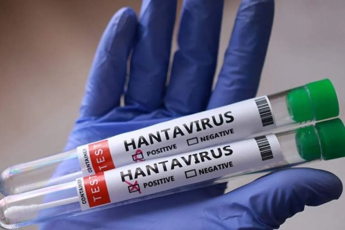 Hantavirus infeksiyasına şübhə: Azərbaycanda cari epidemioloji vəziyyət